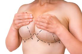 Breast uplift surgery to re-shape your breasts