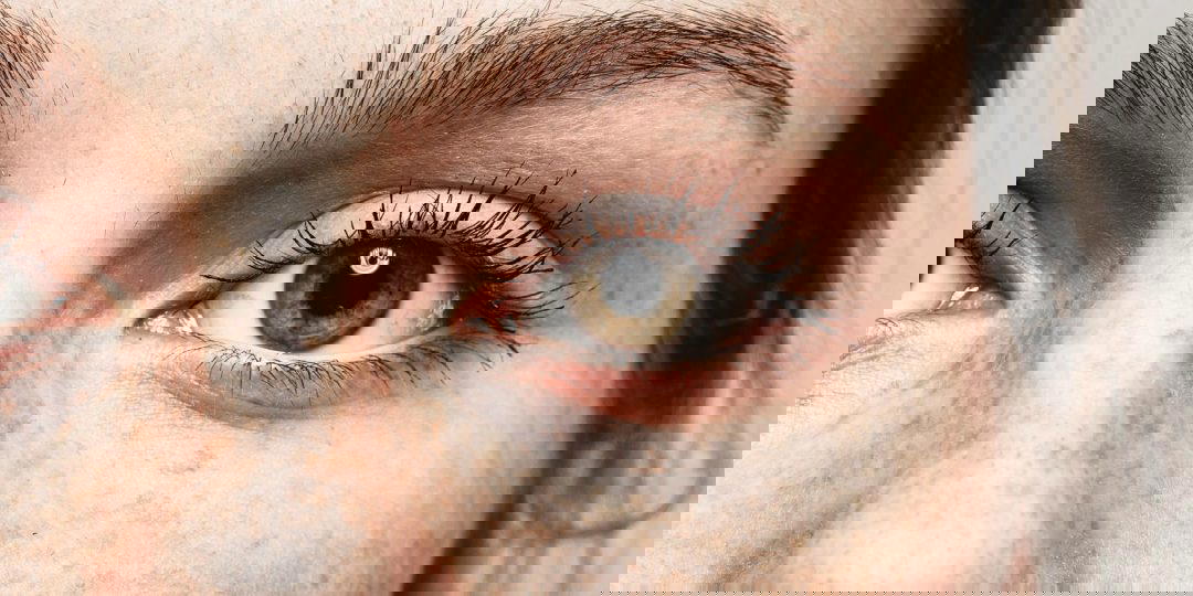 Blepharoplasty – How Eyelid Surgery Works to Refresh Your Appearance