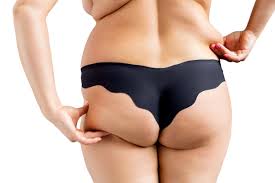 Cosmetic Surgery Dubai: Liposuction 101: A Complete Guide for Beginners